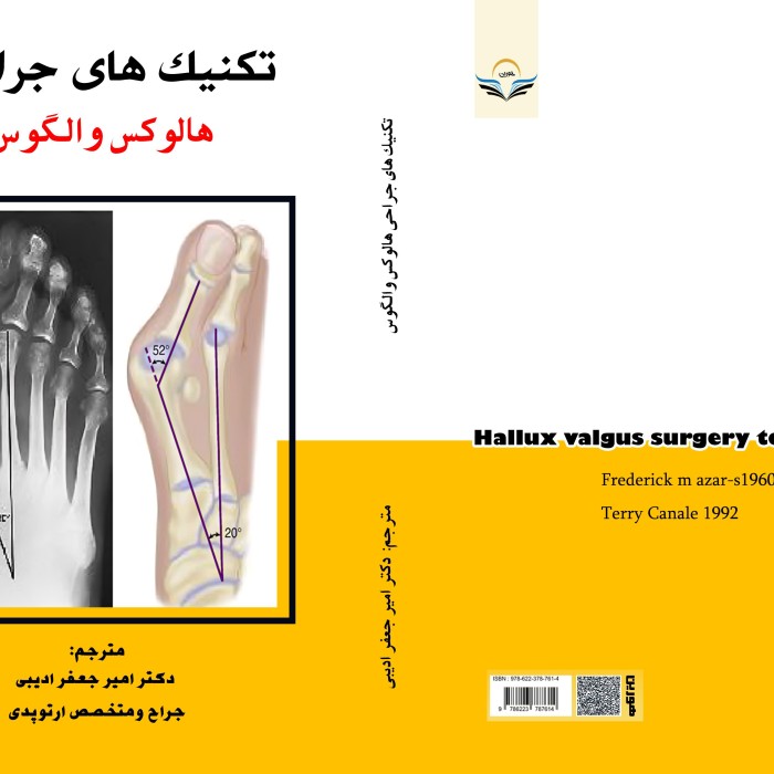 کتاب تکنیک های جراحی هالوکس والگوس