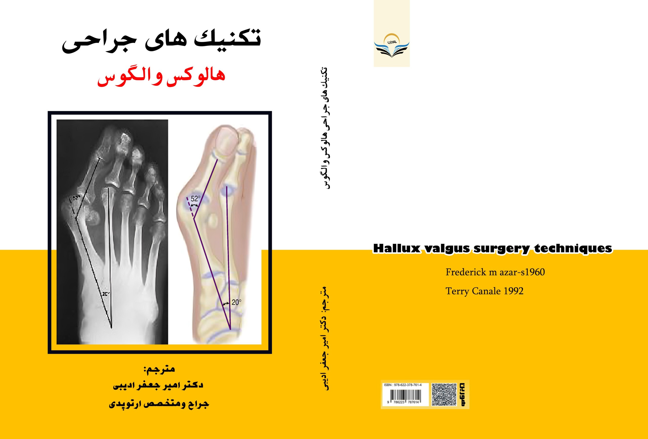 کتاب تکنیک های جراحی هالوکس والگوس